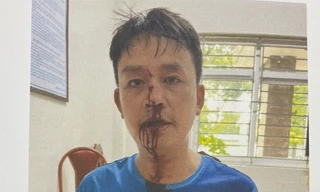 Hà Nội: Ngày mai, xét xử nhóm côn đồ đánh người ‘hội đồng’ tại chung cư Osaka Complex 