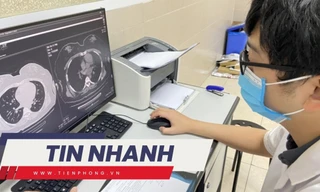 TIN NHANH: Hàng chục ca bệnh cốt tủy viêm xương hậu Covid-19, 13 người tử vong