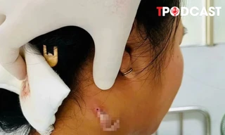 ĐIỂM TIN 2/9: Công điện khẩn về bão Yagi; Vi khuẩn 'ăn thịt người' xuất hiện ở Đồng Nai