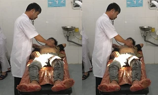 Em C. nhập viện cấp cứu do bạn học đâm. Ảnh: Báo Giao thông