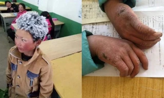 ‘Cậu bé băng giá’ là bức ảnh có sức ảnh hưởng nhất Trung Quốc năm 2018