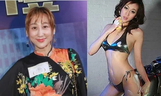 Phát hoảng với gương mặt biến dạng của vợ tài tử ‘Thiên Long Bát Bộ’