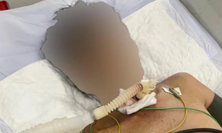 Quảng Nam: Cứu người đàn ông tự cứa cổ, đâm dao vào bụng