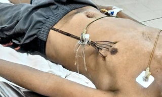 Bệnh nhân Nguyễn Phúc Duy lúc mới nhập viện.