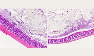 Hình ảnh phóng đại ruột trước và sau ( ảnh trái và phải) sau khi ăn khẩu phần nhiều đường 7 ngày.
