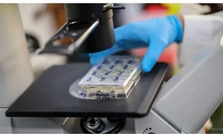 Các tế bào sản sinh kháng thể chống lại COVID-19 được đưa vào soi qua kính hiển vi.