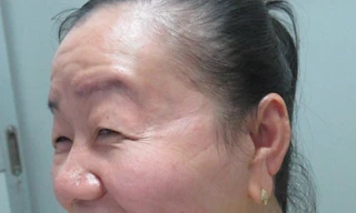 Gương mặt chị Phượng tiếp tục trẻ thêm