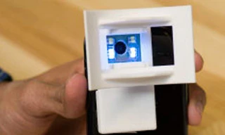 Chẩn đoán ung thư miệng bằng điện thoại