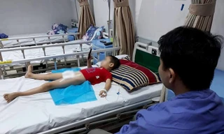 Bệnh nhi điều trị tại Bệnh viện Da liễu Trung ương.