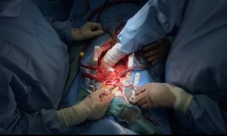 Xin tạm dừng họp Quốc hội để ghép tim cứu người