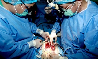 Thực hiện phẫu thuật, ghép tim cho người bệnh tại Bệnh viện Trung ương Huế.