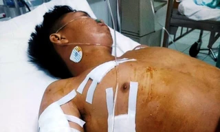 Anh Nguyễn Lầm là một trong hai nạn nhân bị Hưng đâm trọng thương dù không hề có mâu thuẫn từ trước chỉ trong một đêm