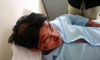 Học sinh T. dính nhiều vết thương tích nghi do bạn học cùng trường đánh, chém, hành hung 