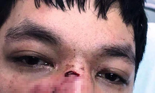 Nạn nhân Nguyễn Văn Lương