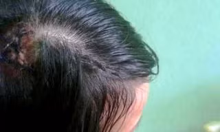 Nữ tài xế Trần Thị Như Băng với với rách lớn ở đầu, do bị bảo vệ Bệnh viện Đại học Y dược Huế đánh đập