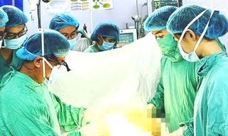 Phẫu thuật tháo hai túi ngực silicon ra khỏi cơ thể bệnh nhân.