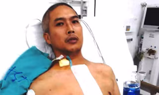 Bệnh nhân Lê Hồng H. đã hồi phục thần kỳ chỉ sau hơn 10 giờ đồng hồ được thay ghép tim