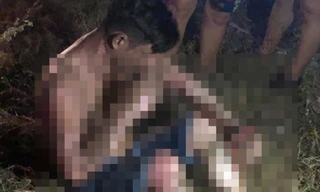 Chàng trai bị bỏng nặng.