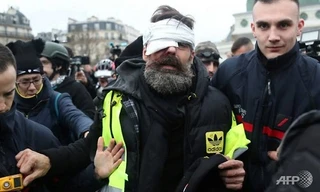 Jerome Rodrigues bị thương ở mắt trong cuộc biểu tình ngày 27/1. Ảnh: AFP