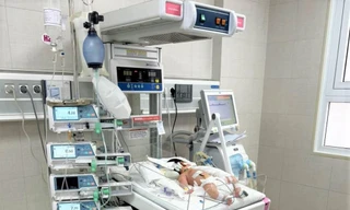 Bé sơ sinh ngộ độc nặng, suy đa tạng, phải thở máy do gia đình dùng thuốc nam điều trị viêm da cho con. Ảnh: Bệnh viện cung cấp