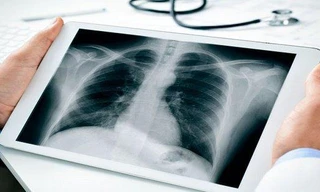 Cứu thiếu nữ Bắc Giang mắc bệnh 'hiểm', 19 tuổi chỉ nặng 18 kg