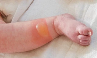 Ảnh minh họa: Internet