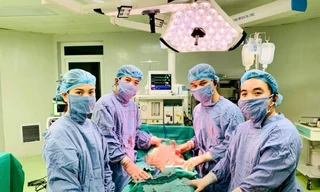 Các BS trong ca phẫu thuật ung thư Liposarcoma tái phát cho người đàn ông 67 tuổi ở Hà Nội: Ảnh: BV cung cấp