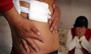 Anh Liu Yongwei đột nhiên bị mất quả thận phải sau khi phẫu thuật ngực. 