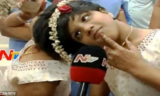 Cặp song sinh dính liền đầu kỉ niệm sinh nhật lần thứ 14 trong bệnh viện