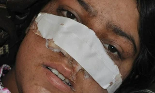 Nạn nhân Reza Gul trên giường bệnh.