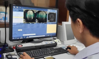 Đi khám ung thư từ 3h sáng, bệnh nhân chờ chụp chiếu đến 3h chiều