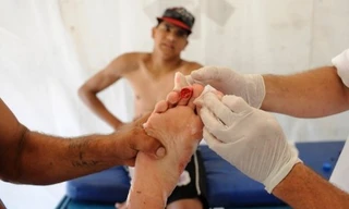 Cá Piranha cắn thịt 70 người