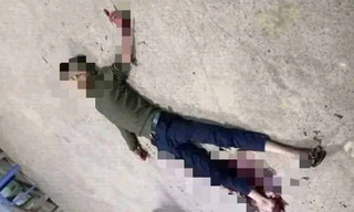 Hình ảnh nam thanh niên tự cắt tay chân nằm bất động trước cây xăng rạng sáng nay 28-10