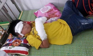 Bé T.X.H. đang nằm cấp cứu tại BV Sản nhi Nghệ An Ảnh: PLO