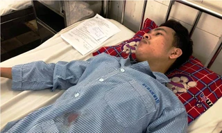 Anh Tùng bị đâm đứt động mạch chủ tay trái.