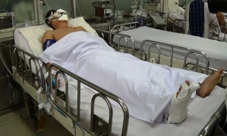 Thượng uý Trần Đức Trung đang được điều trị tại bệnh viện Chợ Rẫy.