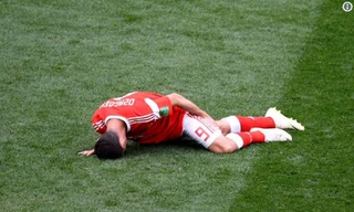  Alan Dzagoev dính chấn thương sau vài 22 phút thi đấu ở trận khai mạc