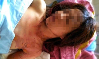 N.T.T.D. tại bệnh viện