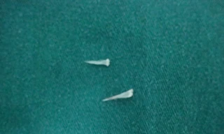 Bé hai tuổi suýt mất mạng vì hóc xương cá