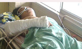 Bị bắn hơn 80 viên đạn chì vẫn sống