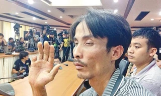 Anh Tai Hua Hai bị băng bắt cóc cắt ngón tay để tống tiền. Ảnh: The Nation 