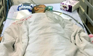 Người bị em trai cắt chân đã qua đời