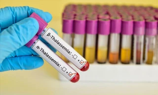 Ngăn chặn bệnh Thalassemia để không ảnh hưởng giống nòi 