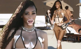 Siêu mẫu bạch biến Winnie Harlow mặc bikini màu nude, khoe dáng ở biển