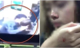 Hình ảnh cô gái bị sàm sỡ trong thang máy và sau khi sự việc xảy ra.