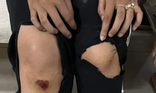 Hai nữ học sinh lớp 11 đạp ngã đối tượng giật điện thoại