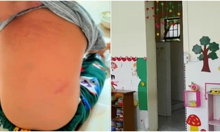 Điểm nhấn giáo dục: Hai giáo viên mầm non bị tố bắt trẻ uống nước bồn cầu