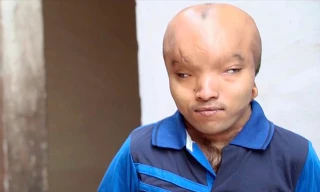 Anshu Kumar bị người dân địa phương gọi là "người ngoài hành tinh".