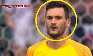 Thủ môn tuyển Pháp suýt nuốt phải côn trùng khi đấu Uruguay