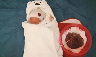 Thứ trưởng Y tế 'bóc mẽ' sai lầm sinh đẻ thuận tự nhiên